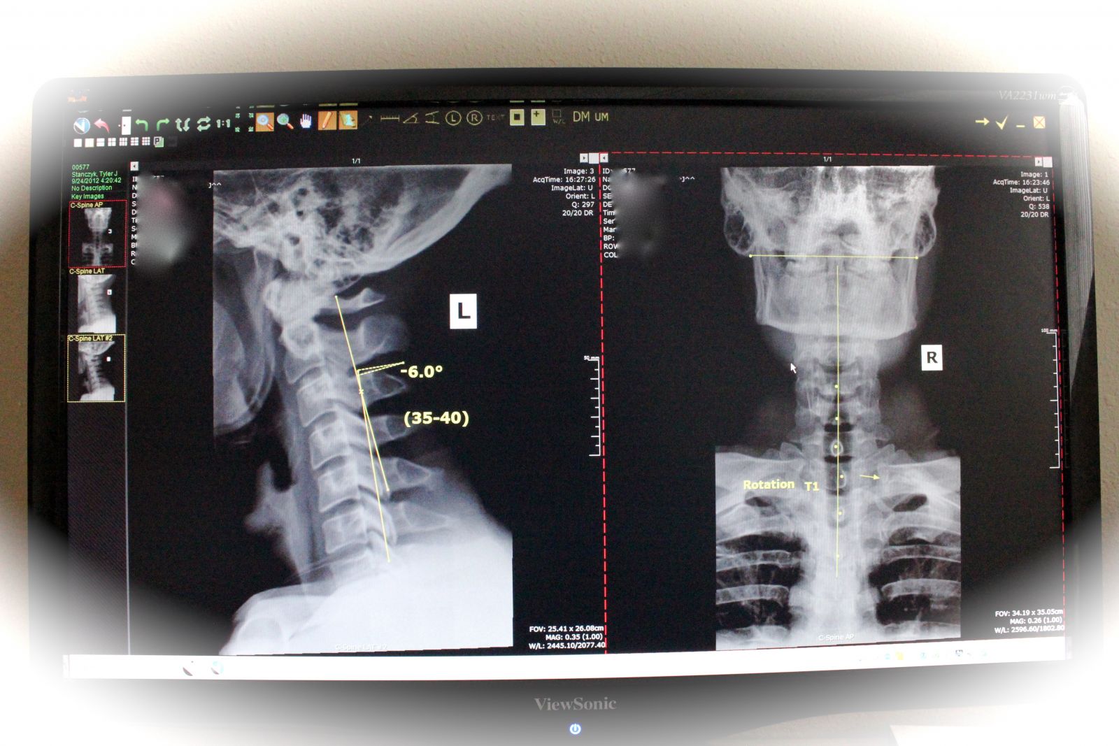 Wisconsin Rapids, MI X-rays